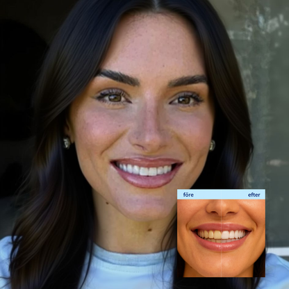 SmilePeopl Tandblekningspenna